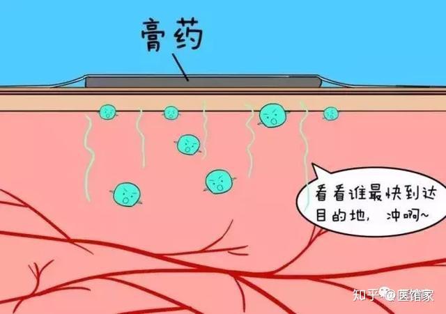 贴膏药的游戏规则-贴膏药游戏：挑战心理极限，你能忍受多久？